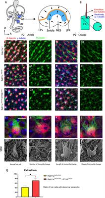 Rab11a Regulates the Development of Cilia and Establishment of Planar Cell Polarity in Mammalian Vestibular Hair Cells